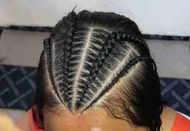 relieve pain from tight cornrows
