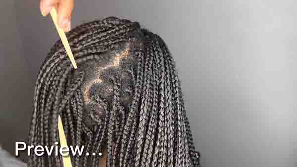 Why Your Braids Are Itching