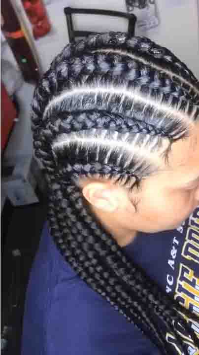 Risks of Tight-Braided Styles